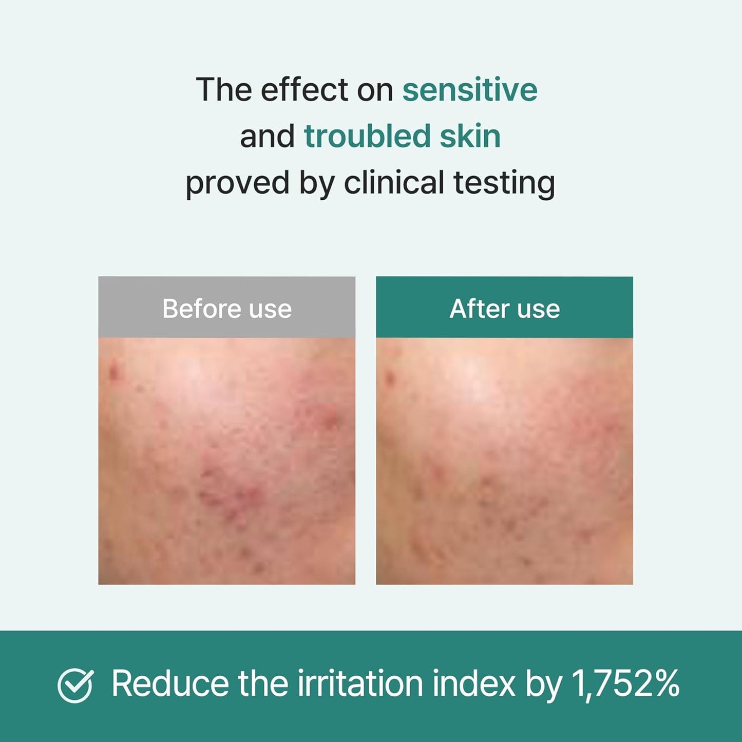 I'm From Licorice Soothing Ampoule 30ml