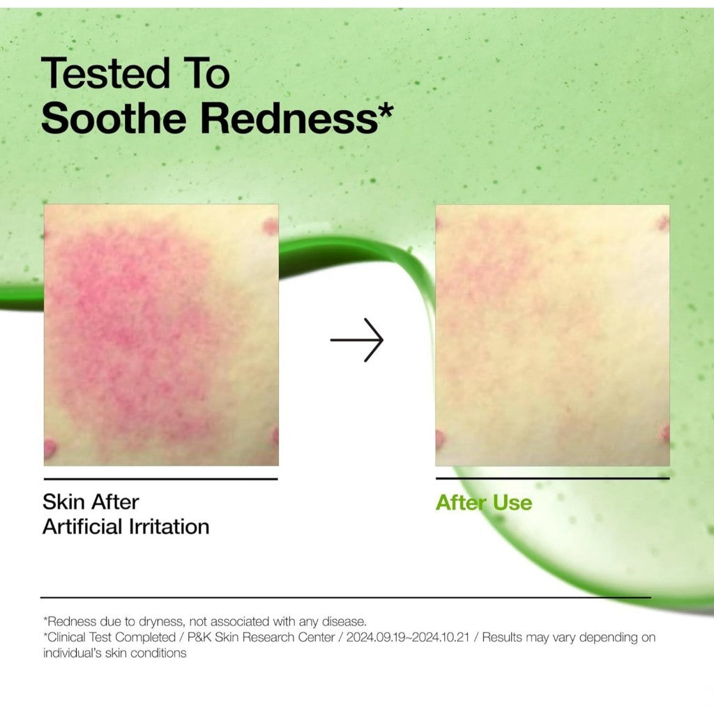 ANUA Azelaic Acid 10 Hyaluron Redness Soothing Serum 30ml