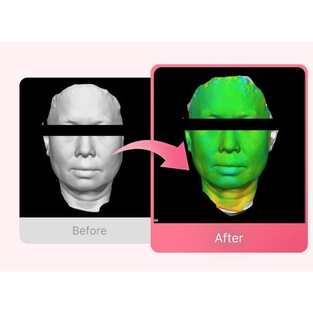 MEDICUBE PDRN Pink Tension Up Mask Set (4 sheets + V-line up band)