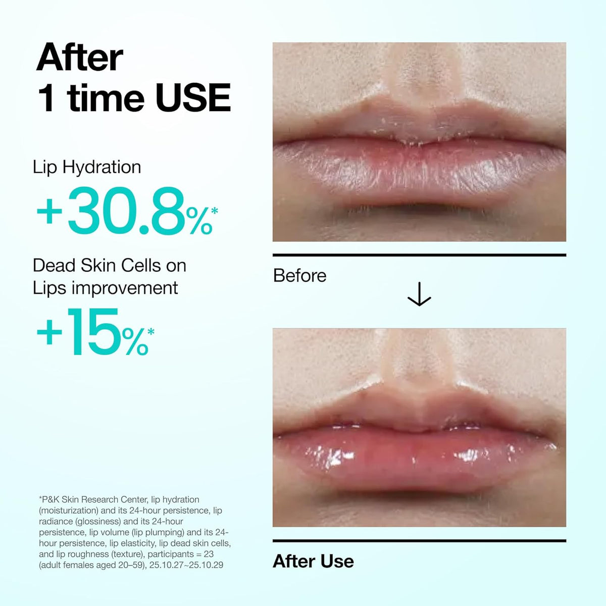 ANUA PDRN Hyaluronic Moisture Lip Serum 10ml