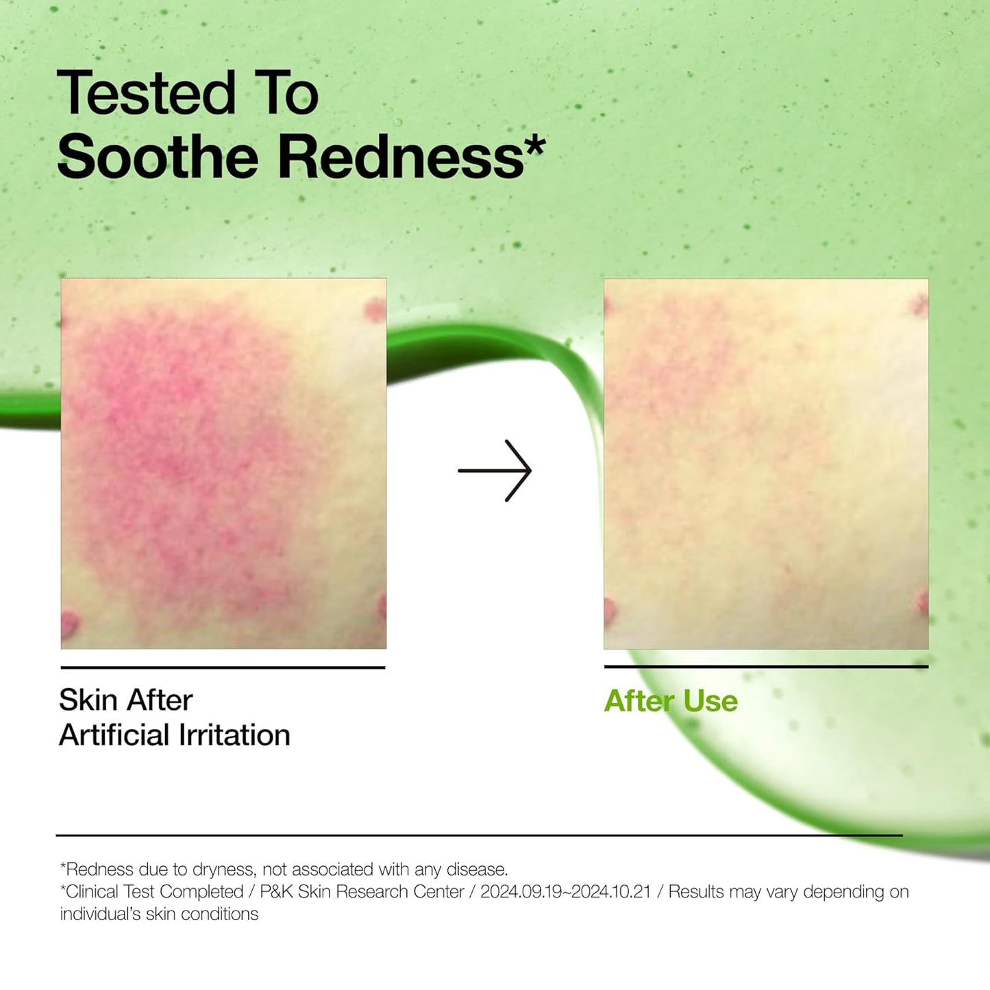 Azelaic Acid 10 Hyaluron Redness Soothing Serum, 30mL