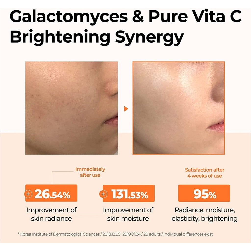 SOME BY MI Galactomyces Pure Vitamin C Glow Toner - 6.76Oz, 200ml - Brightening and Refreshing Effect - Improvement of Skin Irritation and Elasticity - Facial Skin Care