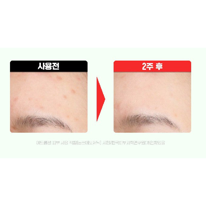 FATION Nosca9 Trouble Toning Ampoule 15mL