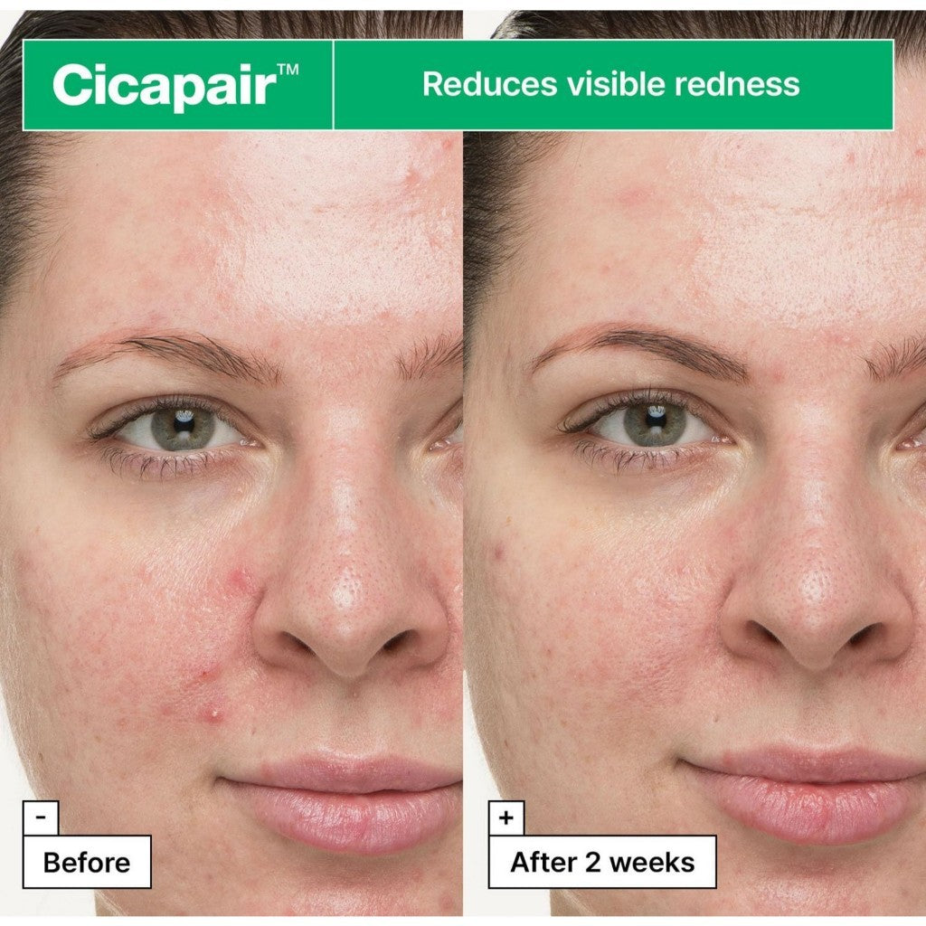 Dr.Jart+ Cicapair So Soothing Treatment, 30mL | for Visibly Irritated Skin | Skin Barrier Repair