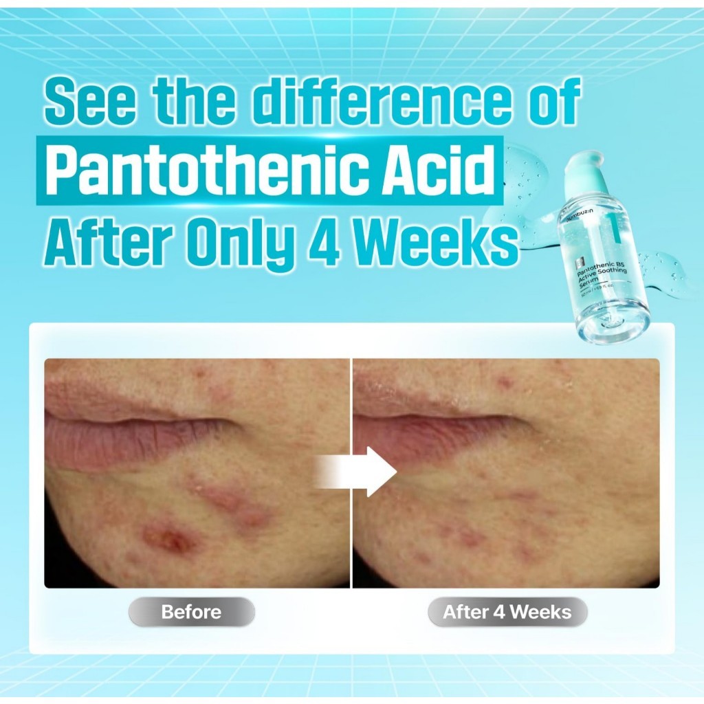 NUMBUZIN No.1 Pantothenic B5 Active Soothing Serum 50ml