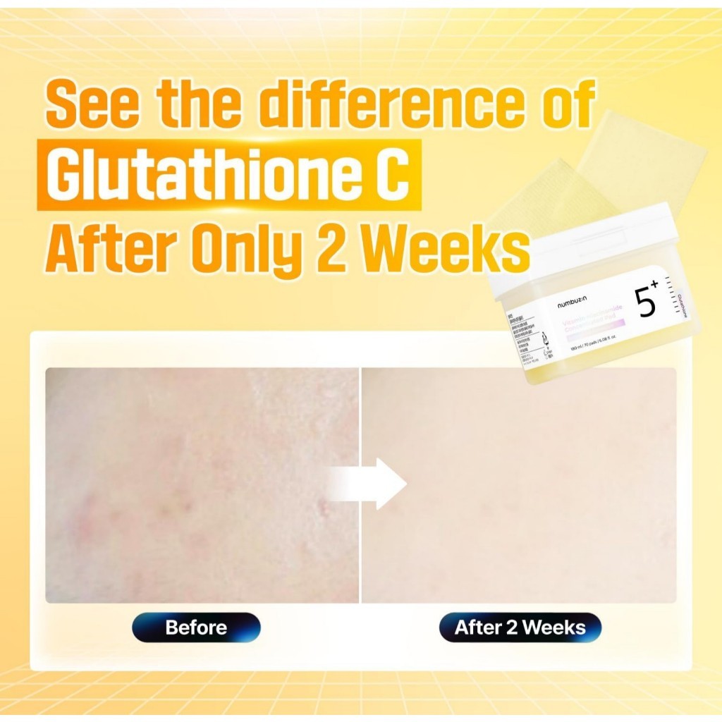 Numbuzin No.5 Niacinamide Concentrated Toner Pad (70 Sheets)