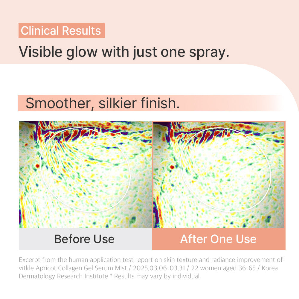 (Free Gift) VITKLE Apricot Collagen Gel Serum Mist 100ml + Free Heart Bottle Keychain