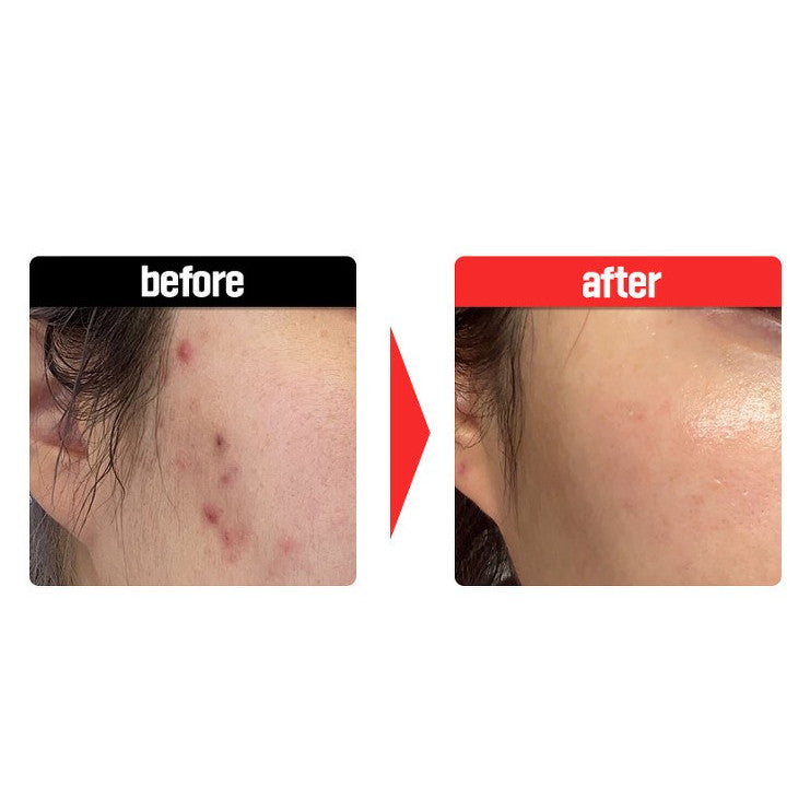 FATION Nosca9 Trouble serum(30ml) - Hydrating Facial, Glass Skin Face Moisturizer for Dry & Sensitive Skin Face