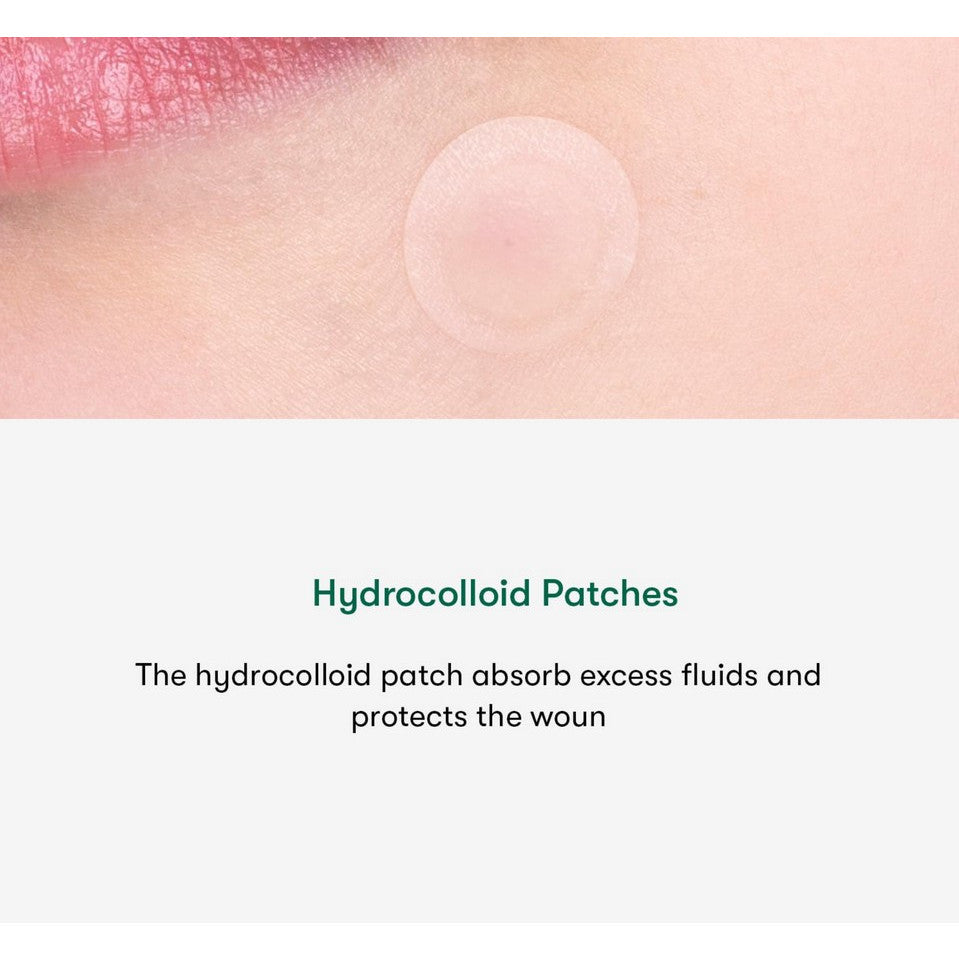 VTCOSMETICS  Spot Patch 12/48 Patches, Pimple Patch