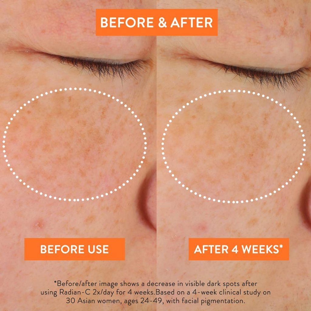 LANEIGE Radian-C Cream: Hydrate, Visibly Brighten & Reduce Look of Dark Spots with Vitamin C EAE & Vitamin E, 30ml