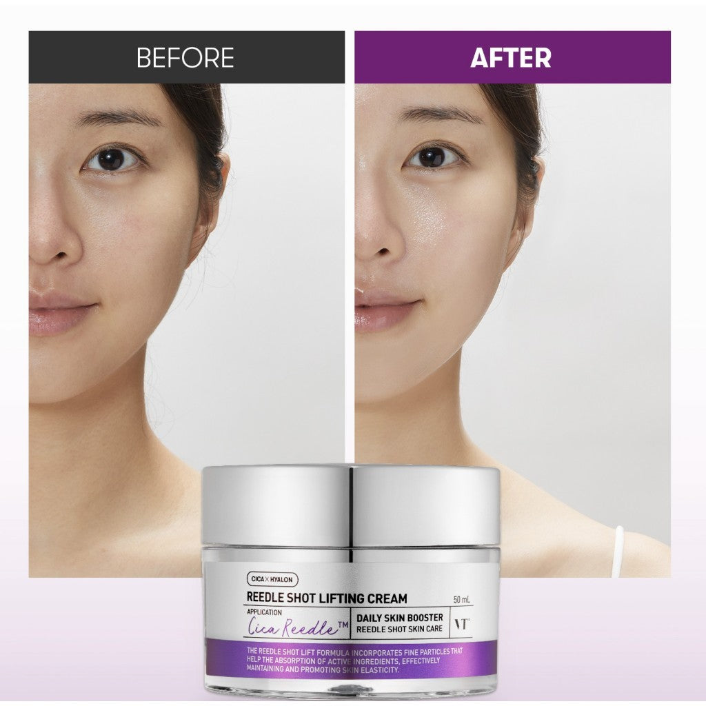 VT Reedle Shot Lifting Cream, 50mL