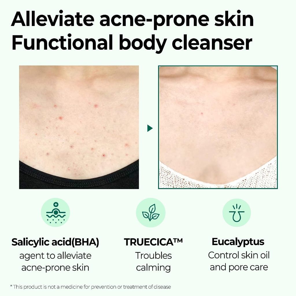 Some By Mi AHA BHA PHA 30 Days Miracle Acne Clear Body Cleanser 400g