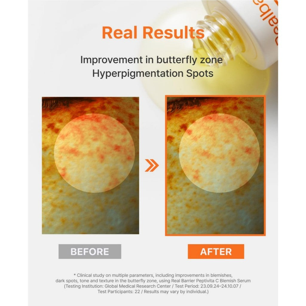 Real Barrier Serum (3 Types), 30mL | Peptivita C Blemish Serum / Retiniol Pore Tightening Serum / PDRN Glow Repair Serum