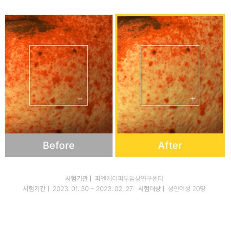 [Cell Fusion C] Toning C Dark Spot Serum, 30mL