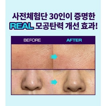 Dr.G R.E.D Blemish Bakuchiol Pore Jet Serum 30ml