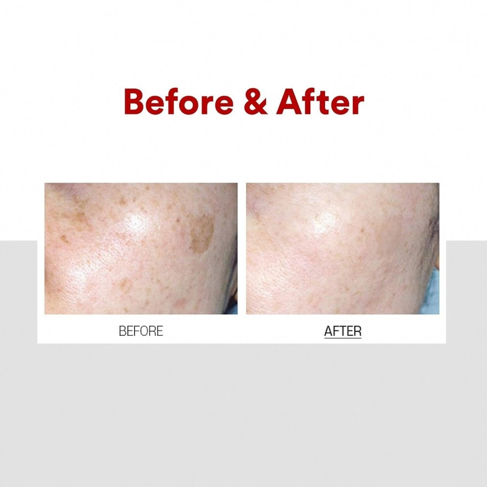 MEDI-PEEL Melanon x / Mezzo / Cica Antio Cream 30ml 3Types