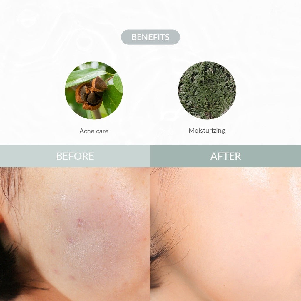 Dr. althea LAST MINUTE SKIN RESCUE ANASTATICA MASK 30ea