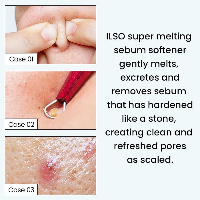 ILSO Super Melting Serum Softener 150mL Special Set (Special Gift: Cotton Pad 40P)