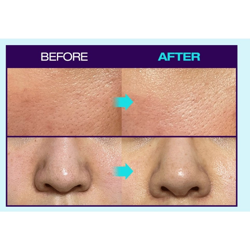 [MINI] Dr.G R.E.D Blemish Bakuchiol Pore Jet Serum 5ml