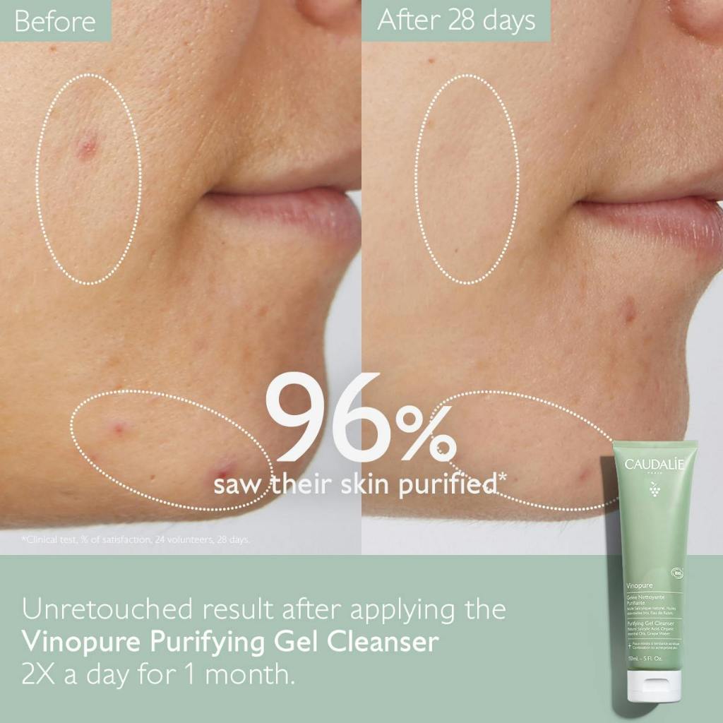 CAUDALIE [MINI] Vinopure Pore Purifying Gel Cleanser 30ml