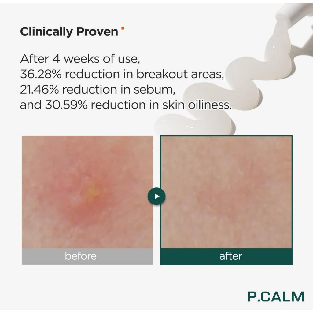 P.CALM Centella Trouble Spot 0.5 fl.oz/15mL
