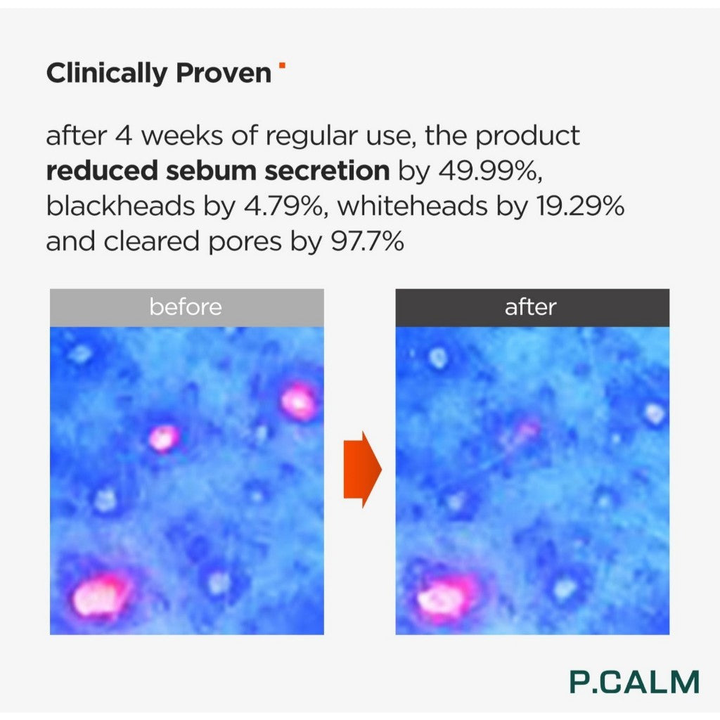 P.CALM UnderPore Foam Cleanser 150ml | Vegan Gentle Deep Pore Cleansing Facial Wash for Sensitive Skin
