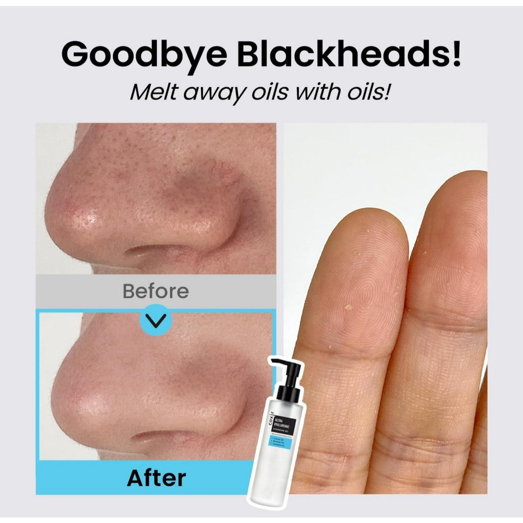 [COXIR] ULTRA HYALURONIC CLEANSING OIL, 150mL