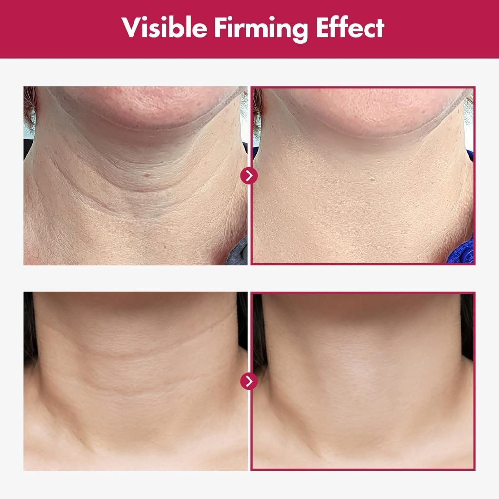 TOSOWOONG Collagen Necktox Cream 50ml