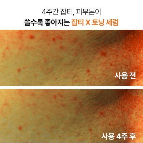 Innisfree Vitamin C Green Tea Enzyme Brightening Serum 30ml/50ml