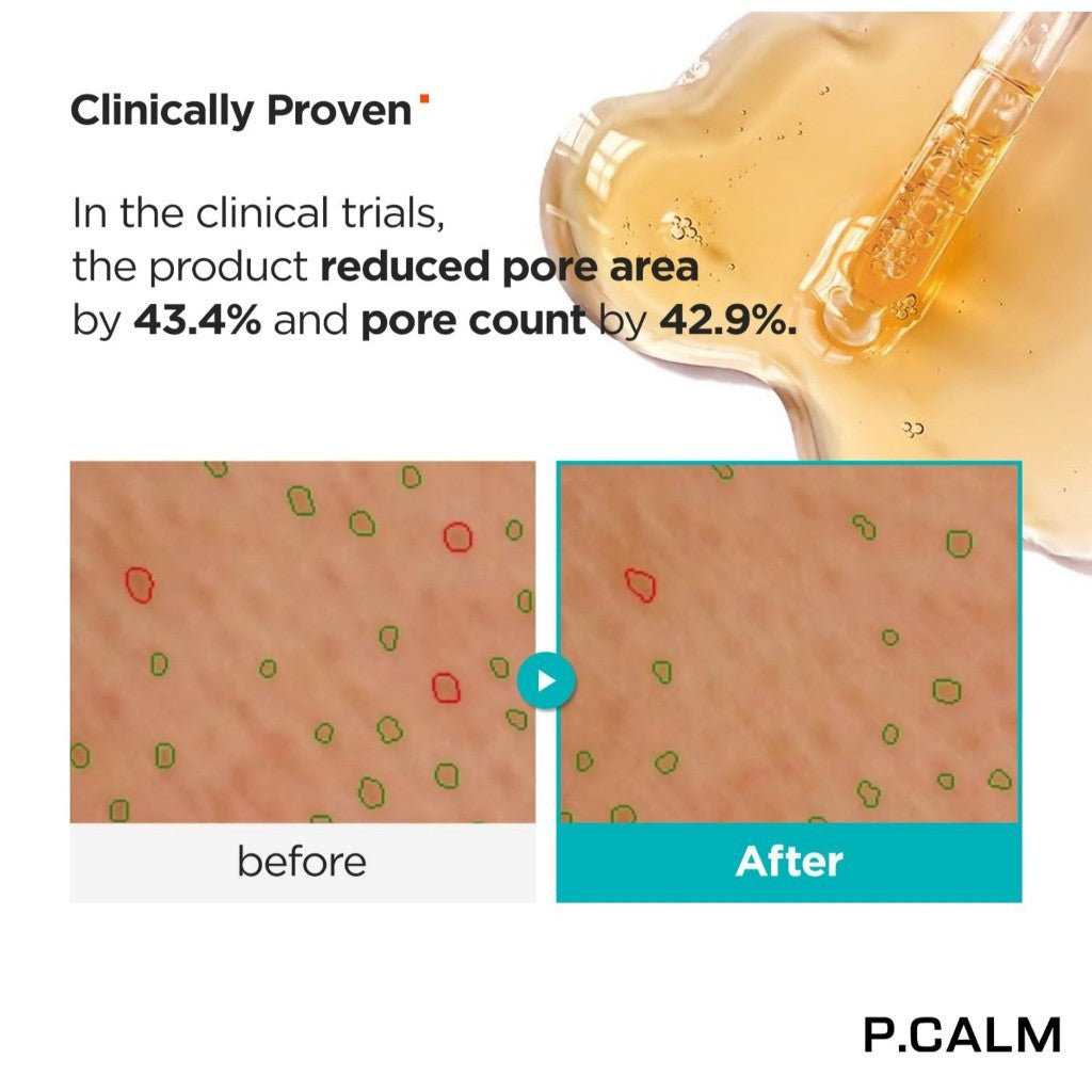 P.CALM Retinolagen Ampoule 30ml | Vegan Fragrance-Free Pore Tightening Skin Serum with Retinol, Vegan Collagen, Bakuchiol