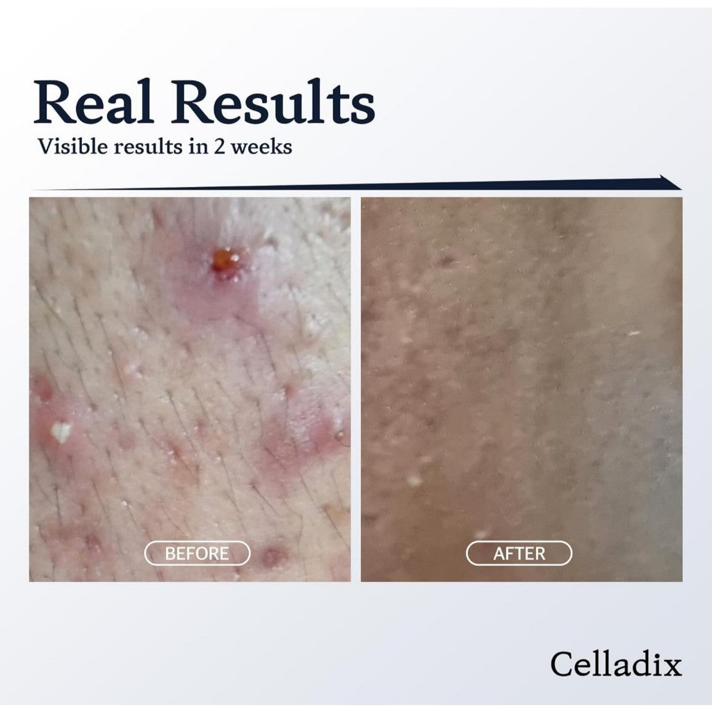 Celladix Skin Barrier Recovery 131 Cream, 80mL