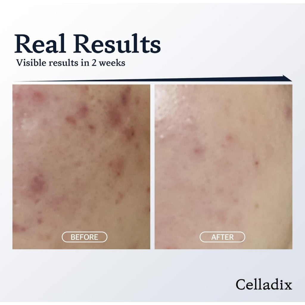 Celladix Skin Balancing pH 5.5 131 Toner Mist, 120mL