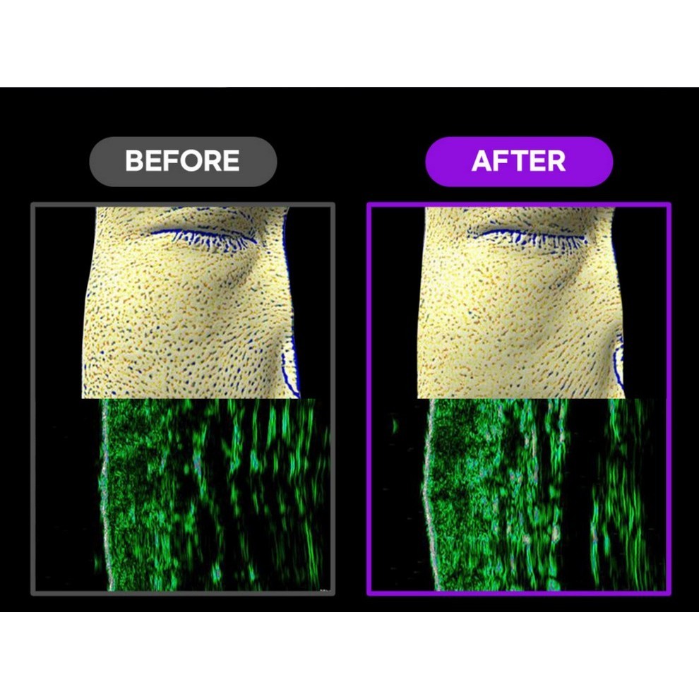 FATION Nosca9 Pore Enhancing (Cream 45mL / Serum 30mL)