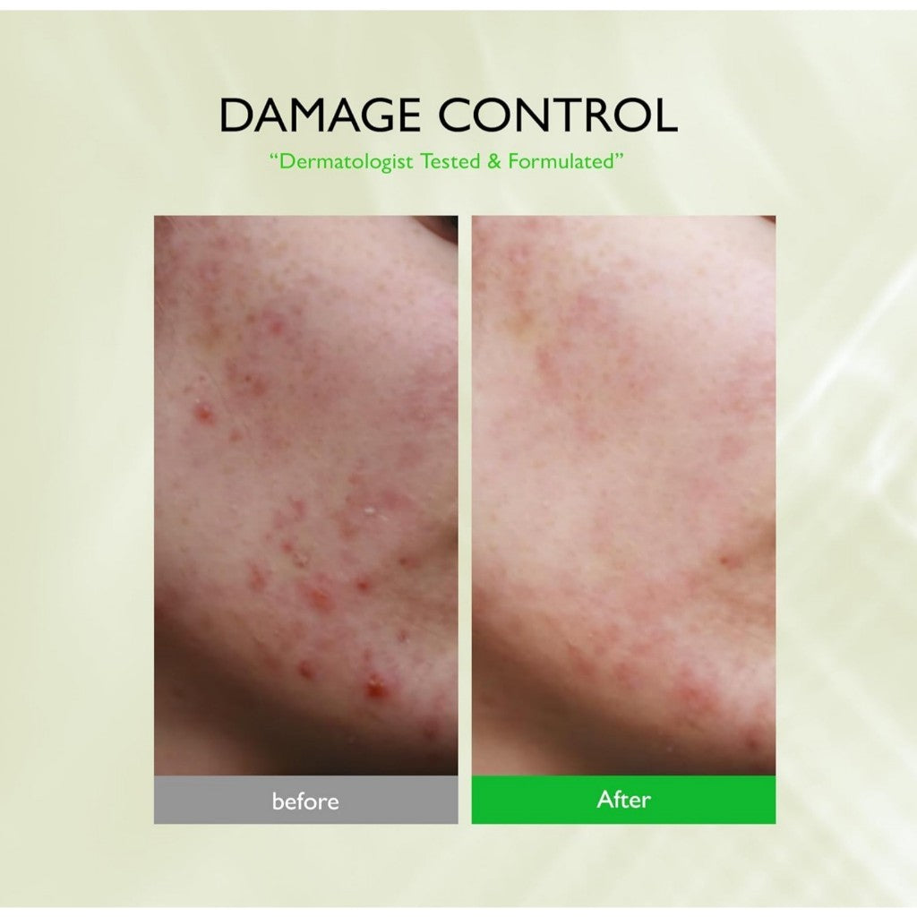 Genabelle Kale 82 Toner Pad, 60 Jumbo Sheets / 240mL | AHA PHA Dead Skin Care Daily Hydrating Toner Pad exfoliating