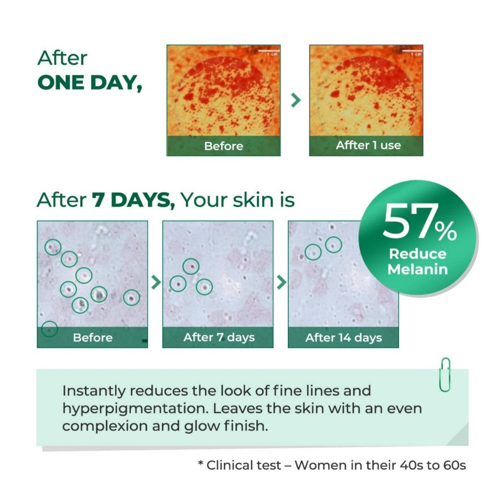 Easydew DW-EGF Melatoning One-Day Ampoule Serum, 8mL