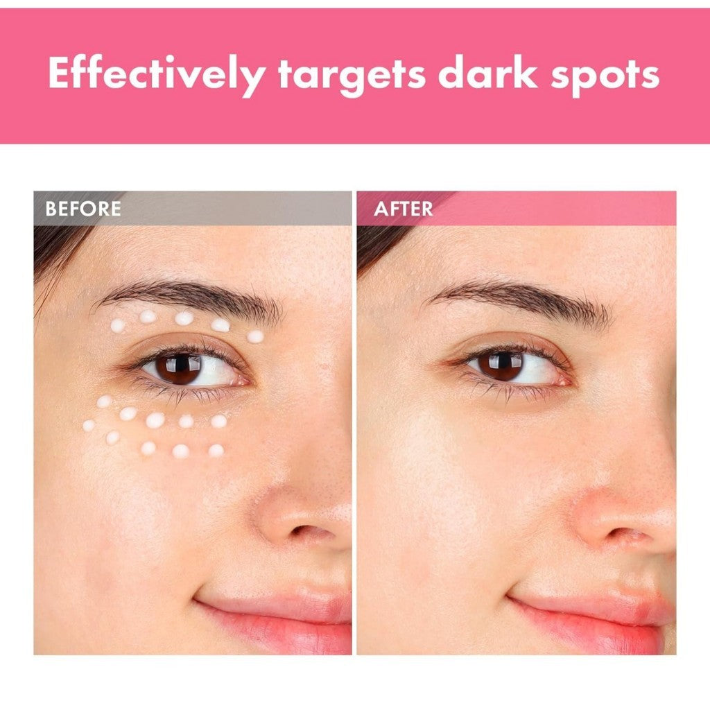 TOSOWOONG Arbutin 7% Intensive Spot Cream, 20mL with 70,000ppm Arbutin, 3% Tranexamic Acid, 1% Niacinamide