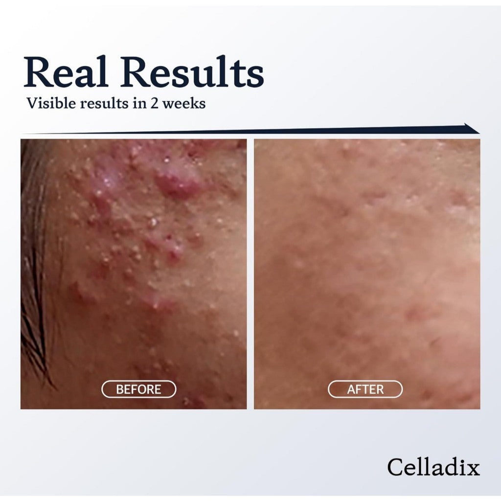 Celladix Sebum Rebalancing Rx 131 Ampoule, 20mL | Minimize Sebum Serum | Tighten Enlarged Pores | Repair Skin Barrier