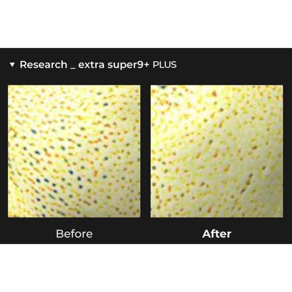 [SET] MEDIPEEL Extra Super 9 + 2.0 Sebum Cleaner & Scraper Set