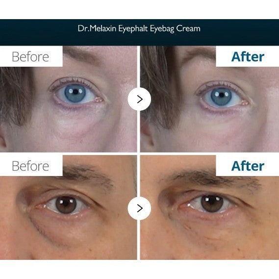 DR.MELAXIN Eyephalt Eyebag Cream 10ml