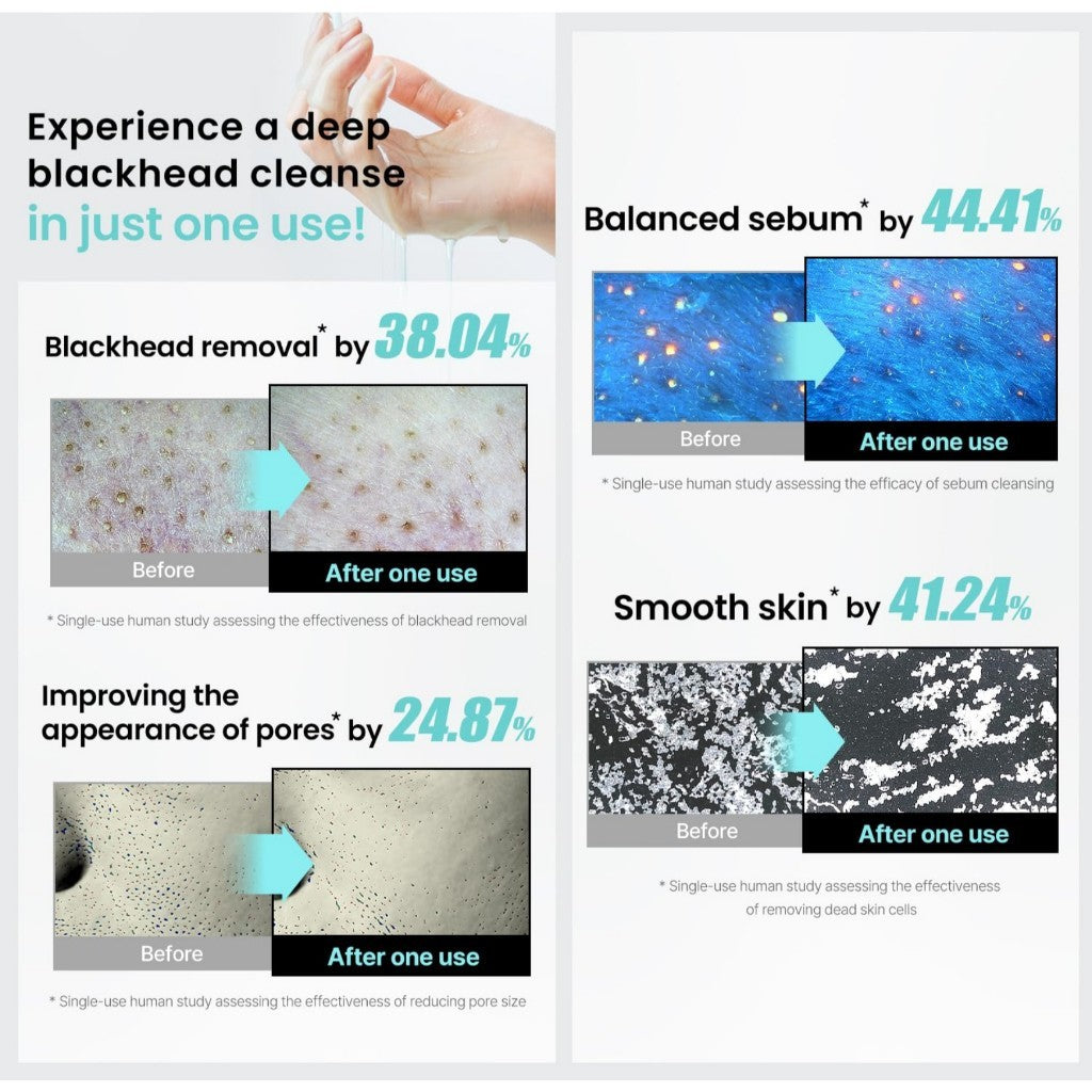 ilso Natural Mild Cleansing Oil / Super Melting Sebum Cleansing Oil, 200ml (2 Types)