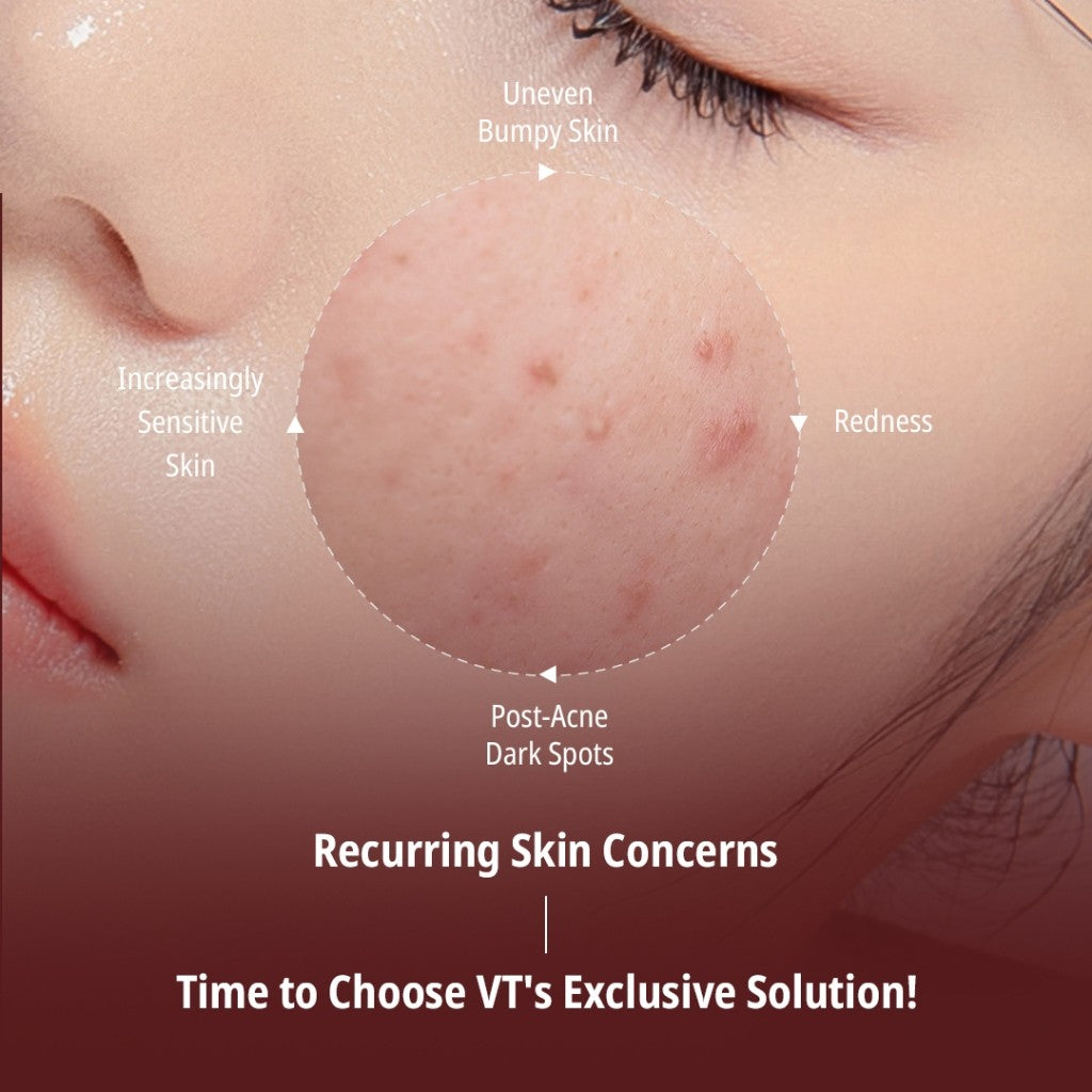 [Glory exclusive] VT AZ CARE LOCK MASK, 100mL | Azelaic acid