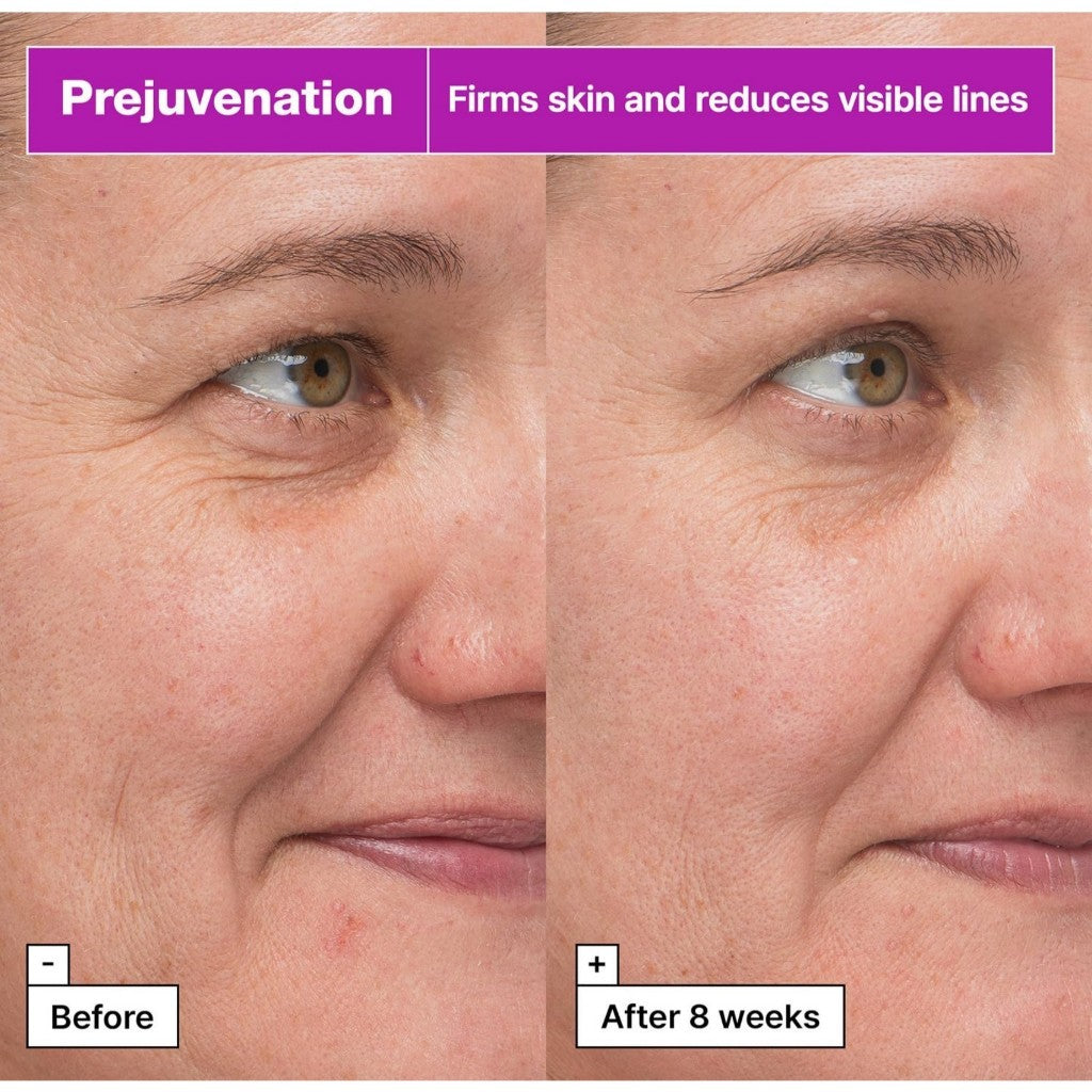 Dr.Jart+ Prejuvenation Firming Bakuchiol Serum, 50mL | for Preventative Aging | Anti Aging Serum