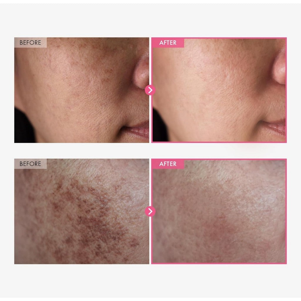 TOSOWOONG Arbutin7.0 + TXA 4.0 Cream, 50mL | Arbutin 7% + Tranexamic Acid 4% Cream