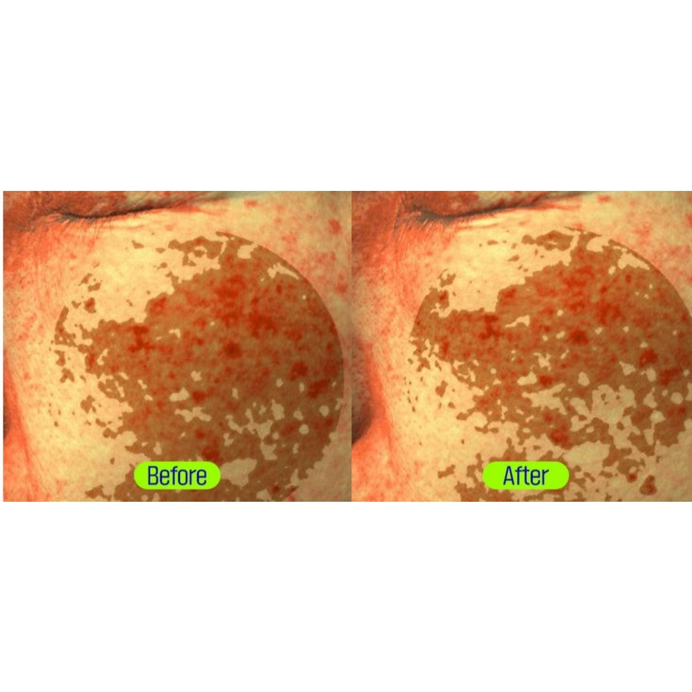 [FATION] Mela Zero Dark Spot Toning Ampoule, 32mL