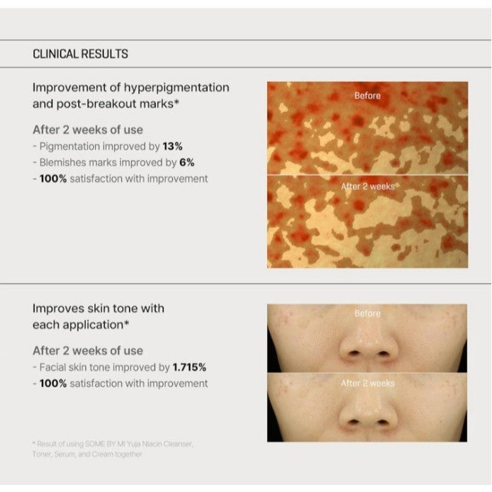 SOME BY MI Yuja Niacin Anti Blemish Cream, 60mL