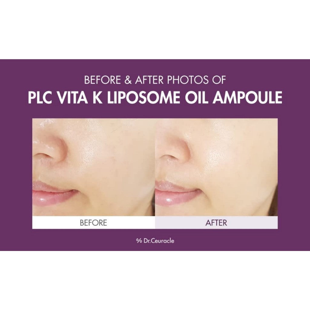Dr.Ceuracle PLC Vitamin K Liposome Oil Ampoule, 50mLㅣSpecial Care for Toning, Glowing, Hydration, BrighteningㅣSkin-Friendly Water&Oil Layer Formula