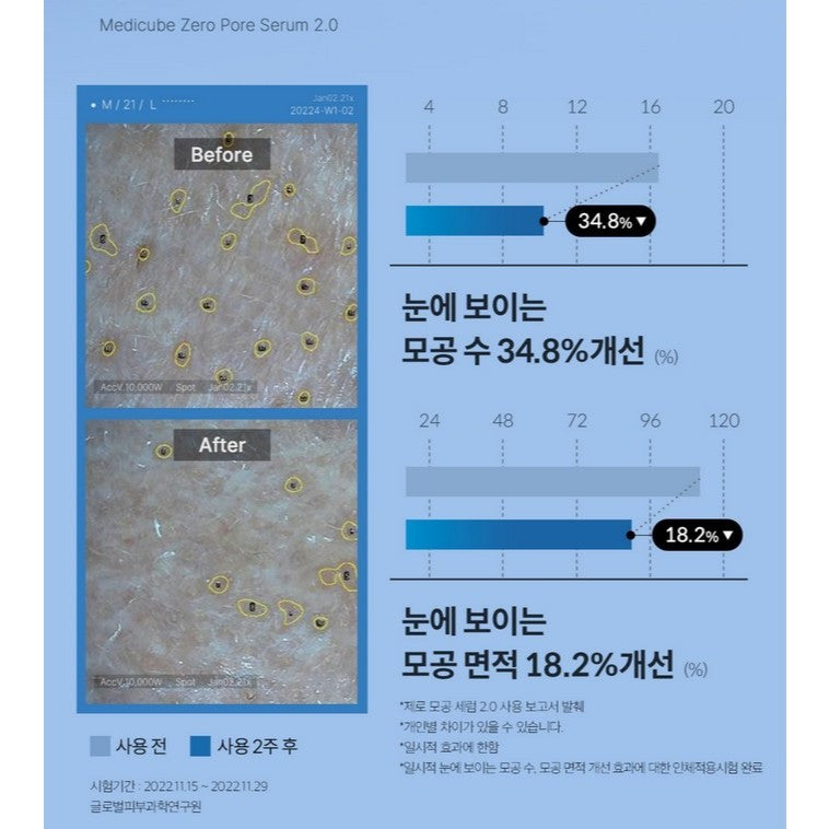 [NEW] MEDICUBE Zero Pore Serum 2.0 37ml