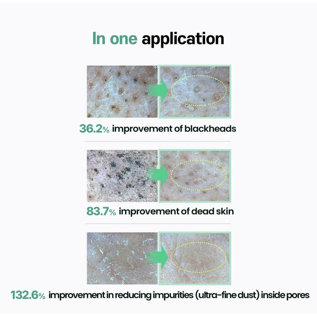 ilso Natural Mild Cleansing Oil / Super Melting Sebum Cleansing Oil, 200ml (2 Types)