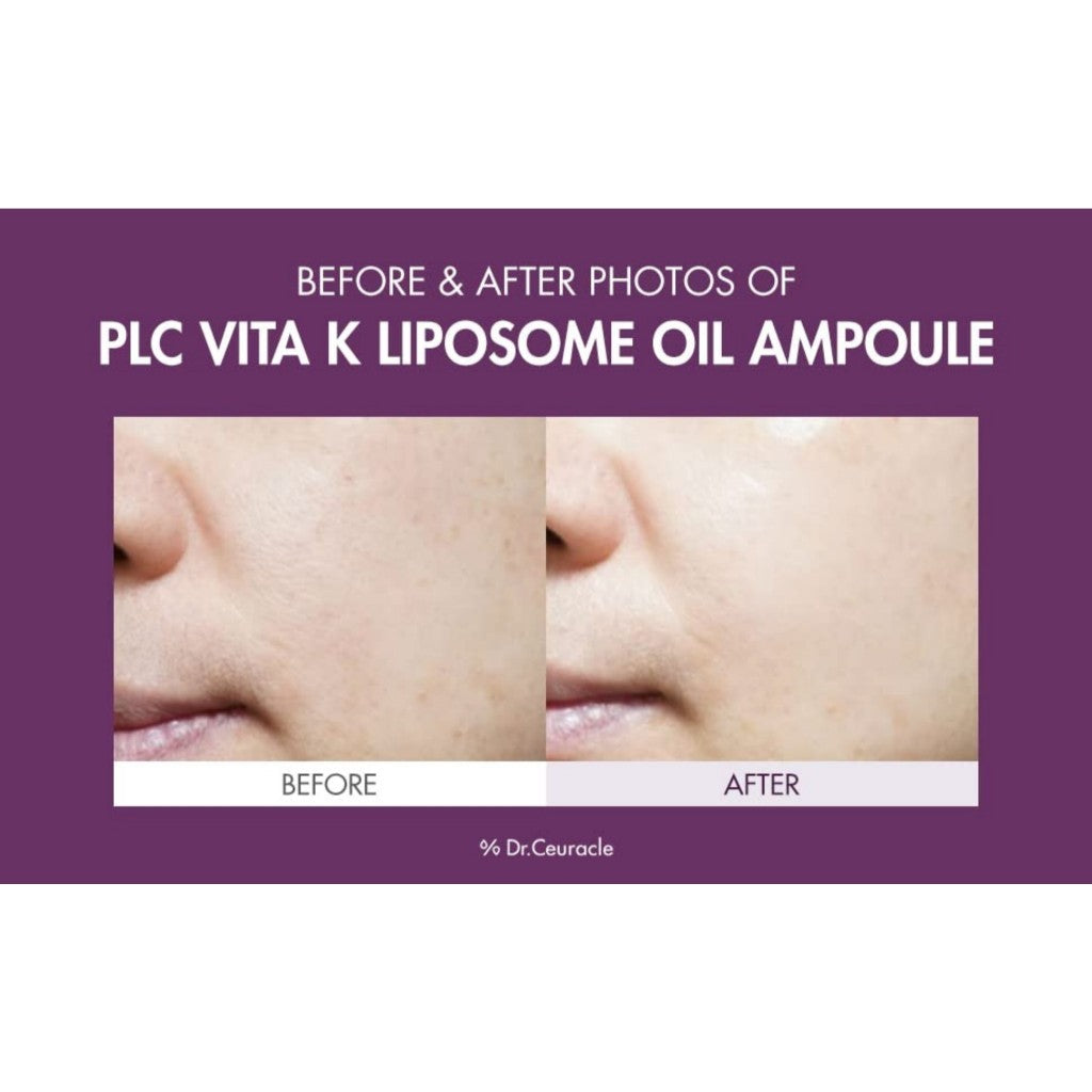 Dr.Ceuracle PLC Vitamin K Liposome Oil Ampoule, 50mLㅣSpecial Care for Toning, Glowing, Hydration, BrighteningㅣSkin-Friendly Water&Oil Layer Formula