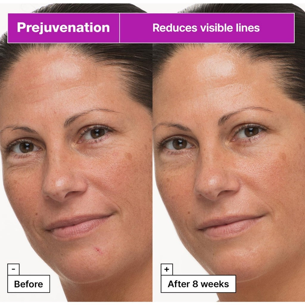 Dr.Jart+ Prejuvenation Firming Bakuchiol Cream, 50mL | for Preventative Aging | Anti Aging Face Cream